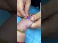 Intramuscular Injection Safely | Nurse-Level IM Injection Step-by-Step Training Guide Class 27