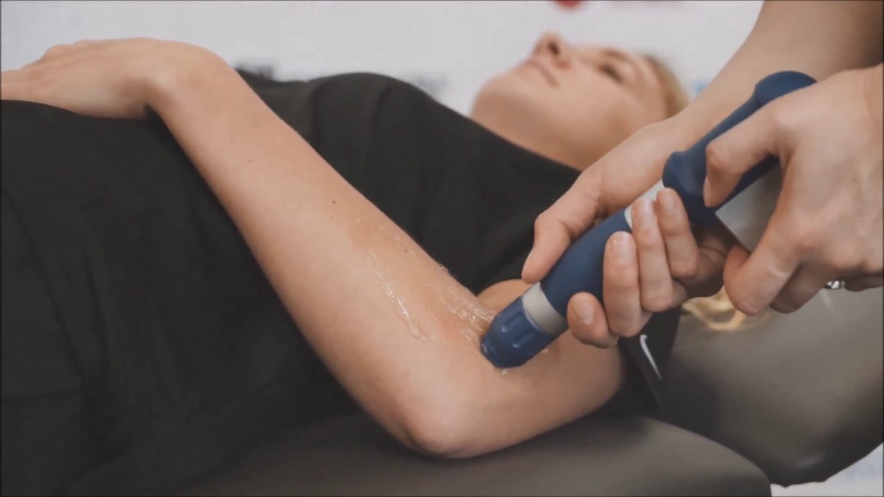 Shockwave Therapy for Myofascial Pain - Hyperformance Physio