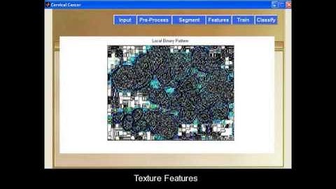 Semi-Automatic Segmentation and Classification of Pap Smear Cells Matlab Project
