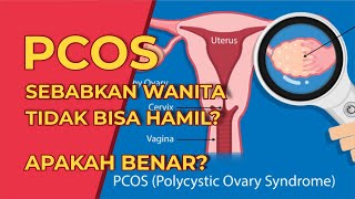 Pcos Sebabkan Wanita Tidak Bisa Hamil   Mitos Vs Fakta