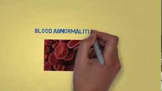 Arthritis Treatment And Side Effects Of Azulfidine (sulfasalazine)