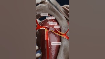 Thrombosis 3D animation | clot formation in the subclavian artery explained in 3D with VOKA