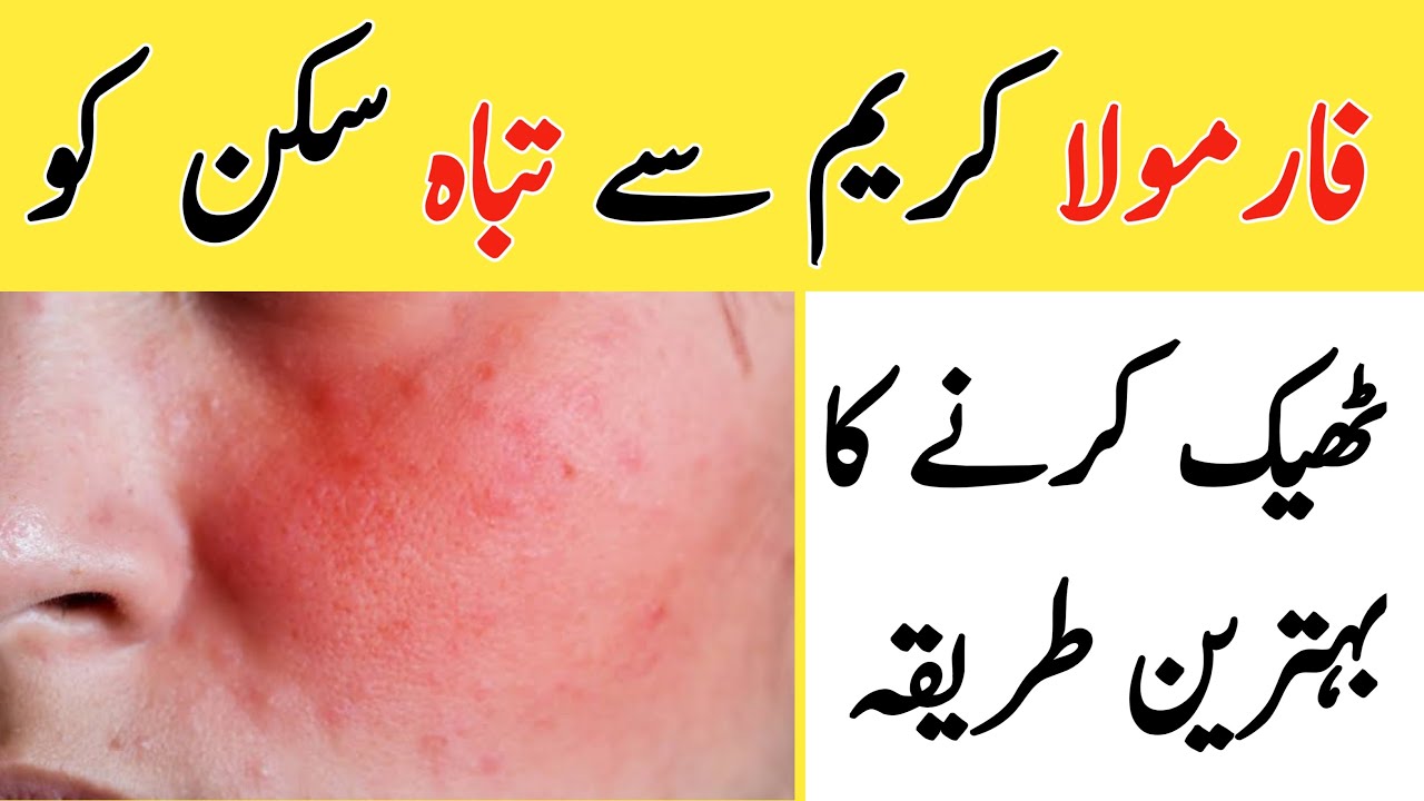 Formula Cream damage skin Repair Formula Patli Skin Ko kaise Gora