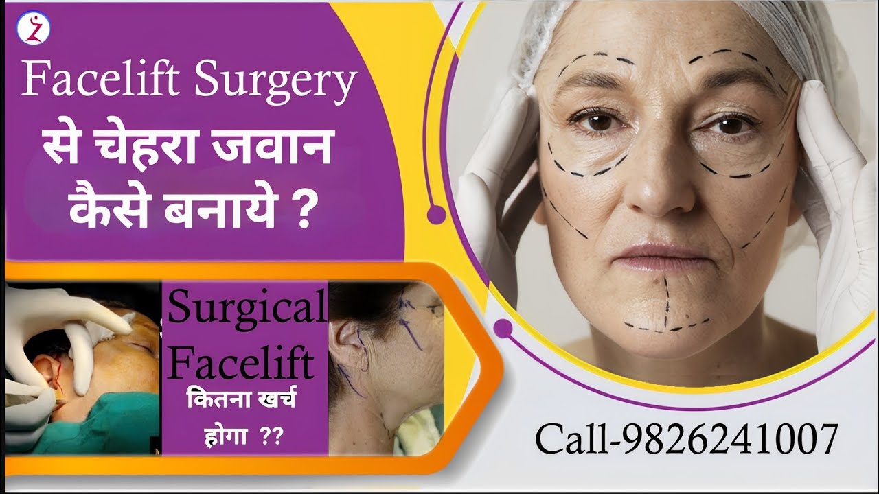 FaceLift Surgery In Lucknow | FaceLift Surgery Cost In Lucknow | Zenith Clinic