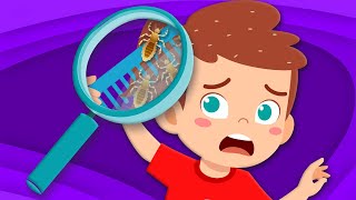 Learn About Lice & How To Get Rid Of Them! | Human Body Song For Kids | KLT Anatomy