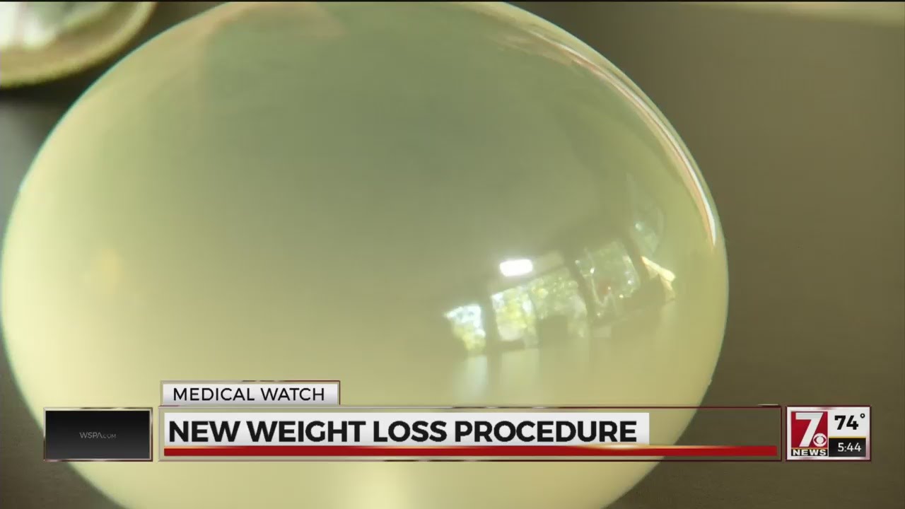 Balloon weight loss procedure new nonsurgical alternative YouTube