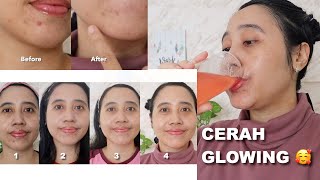 WAJAH KUSAM JADI CERAH DAN GLOWING SEHAT ? KONSUMSI 2 MINGGU HASILNYA SEPERTI INI Maria Soelisty