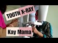 Dental X-Ray at Prime Dent Park Mall Mandue City Cebu