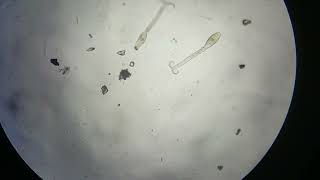 Human Schistosoma Mansoni Cercariae