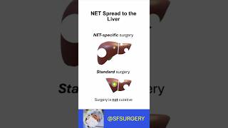Surgery for Neuroendocrine Tumor Liver Metastases (NELMs): Liver-sparing Techniques are Essential!