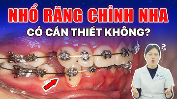 Nhổ Răng Chỉnh Nha | Hiểu Rõ Để Không Bị Bác Sĩ Nhổ "Oan" Răng Thật Khi Niềng!