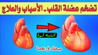 تضخم عضلة القلب - الأسباب والعلاج