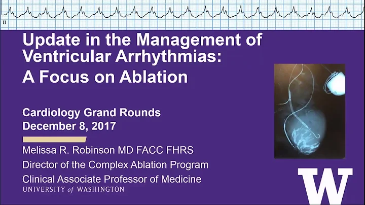 Update in the Management of Ventricular Arrhythmia...