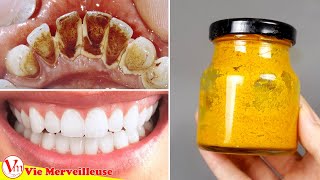 Formule Secrète De Dentiste: Enlever La Plaque Dentaire En 2 Minutes Avec Ce Dentifrice