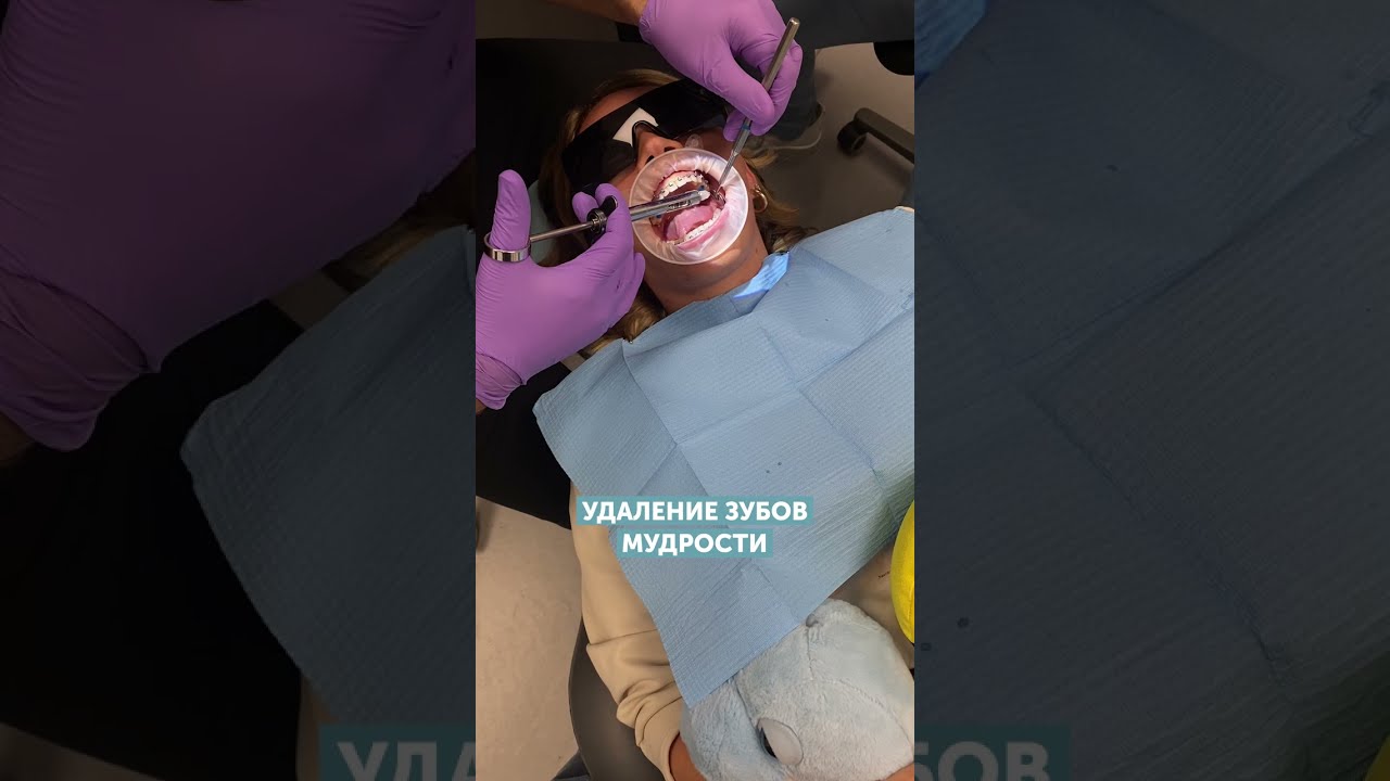 Удаляем зубы мудрости #shorts