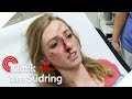 "Ich hasse meine Nase": Nele (15) findet sich hässlich | Klinik am Südring | SAT.1 TV