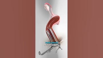 De meest ongemakkelijke levensreddende procedure ter wereld (3D-animatie)