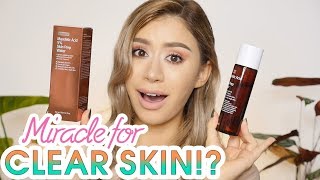 BYWISHTREND MANDELIC ACID 5% SKIN PREP WATER REVIEW | Clear Skin Fast?!