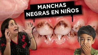 Manchas Negras en los Dientes ¿Qué debo hacer? Manchas Negras en los Dientes ¿Qué debo hacer?