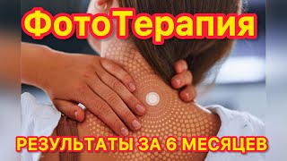 МОИ РЕЗУЛЬТАТЫ ОМОЛОЖЕНИЯ ЗА 6 МЕСЯЦЕВ ‼️ БОЛИ В БЕДРЕ ПРАКТИЧЕСКИ УШЛИ‼️ ФОТОТЕРАПИЯ🌞 БЕЗ ЛЕКАРСТВ