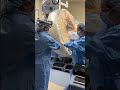 My viral glove technique