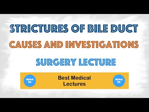 Stricture of Bile Duct : Causes and Investigations