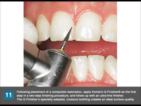 How to simplify cavity preparation and chairside finishing and polishing procedures