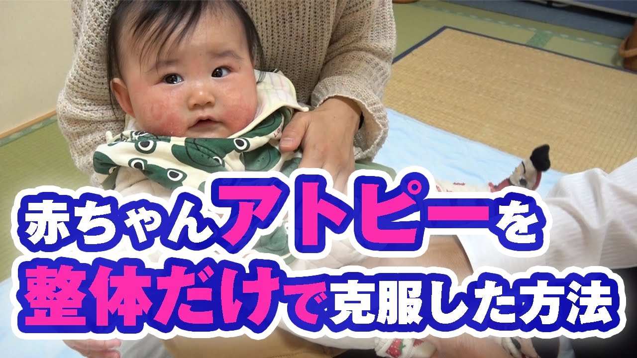 花粉症患者さん必見 アレルギー整体の権威が教える 花粉症を根本改善する唯一無二の方法とは ゴッドハンド通信 星野トチロー Youtube