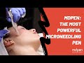 The best microneedling pen  mdpen