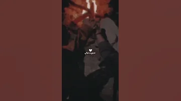 عمري وحياتي وساكنة ب قليبي بس انتي وحدك دواية وطبيبي حالات واتس قصيرة 