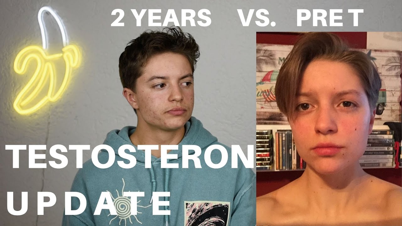 TESTOSTERON UPDATE 2 JAHRE - ftm transgender