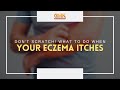 Don't Scratch! What to Do When Your Eczema Itches (PART 2) | Usapang Pangkalusugan