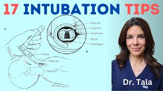 16+ tricks for a successful NEONATAL endotracheal intubation!!!