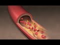 Mayo Clinic Minute: The role of cholesterol in heart health