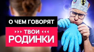 картинка: Какие РОДИНКИ- опасны? 10 вопросов о родинках и загаре #онкология #кожа #родинки