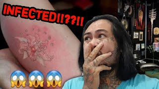 What to Do if your TATTOO gets INFECTED