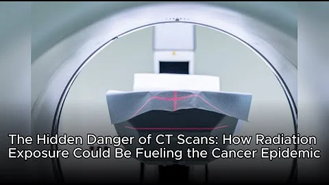 The Hidden Danger of CT Scans: How Radiation Exposure Could Be Fueling the Cancer Epidemic