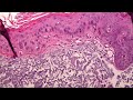 Dermpath 12 Dr Rania Elakad 