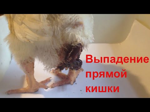 ШОК!!! ВЫПАДЕНИЕ ПРЯМОЙ КИШКИ!! что делать?