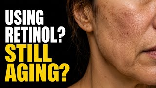 Why Your Retinol Stopped Working (The Conversion Problem Nobody Talks About)