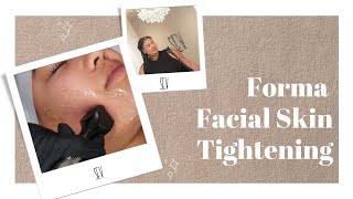 Forma Facial Skin Tightening Procedure