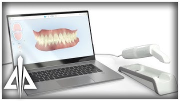 iTero Element Flex | Trinity Animation