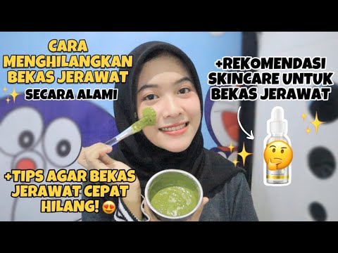 REKOMENDASI MASKER UNTUK JERAWAT, BEKAS JERAWAT, DAN BERUNTUSAN. 