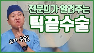 윤곽수술 3탄! 턱끝수술? 이부전진술? 신경이 둔해진다구요?! 전문의가 정확하게 알려드립니다