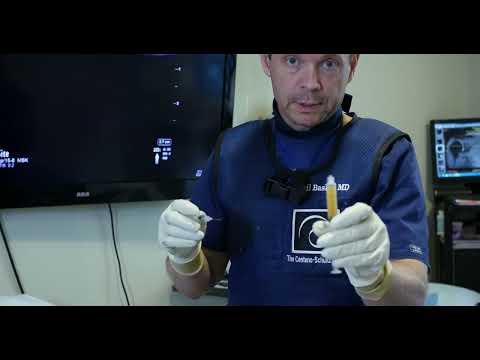 Stem Cell and
