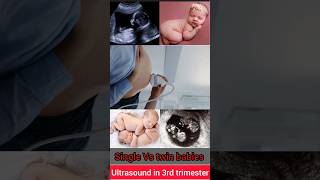 Single Vs twin babies||ultrasound in 3rd trimester