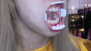 美女姐姐口腔检查蛀牙烂牙扁桃体检查了解更多口腔检查Q507871282