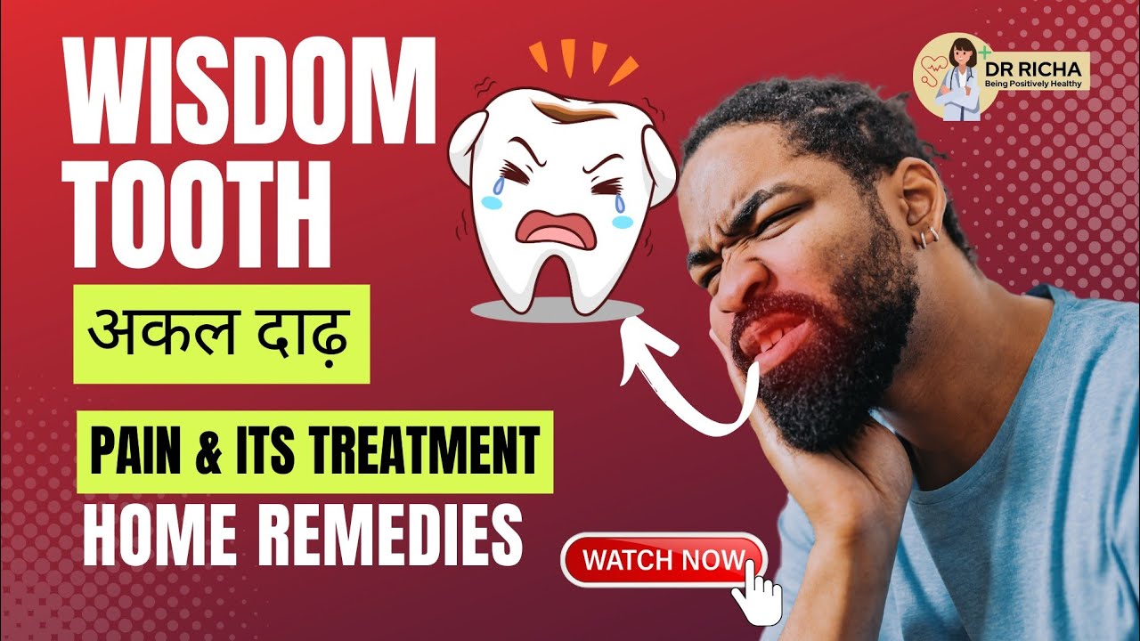 अक्कल दाढ़ दर्द के घरेलू उपाय और इलाज Wisdom Tooth Pain Treatment