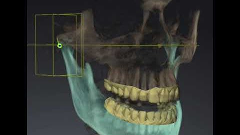 SiCat Function. Functional Diagnostics. Stomatology