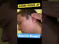 【ASMR】WEIRD EAR MASSAGE🍴 /Ear Burning 🔥 #asmrmassage #earmassage #asmr